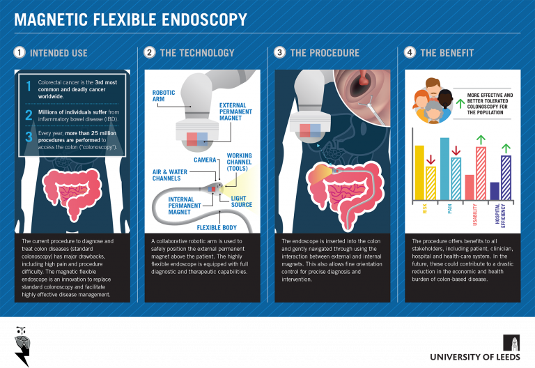 Painless colonoscopy — how magnetic capsule endoscopy works